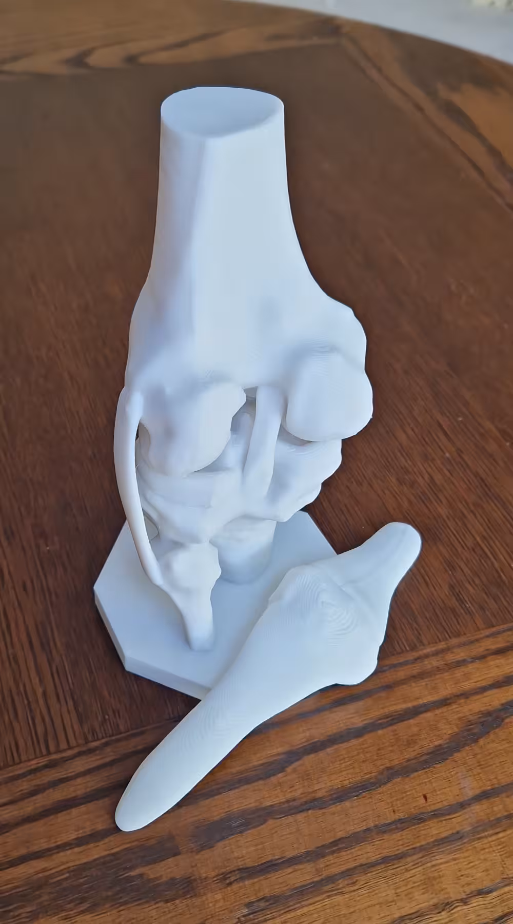 Preview - High-precision anatomical knee joint