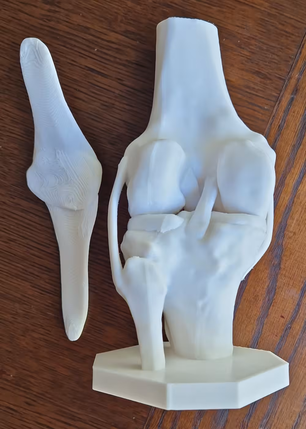 Preview - High-precision anatomical knee joint