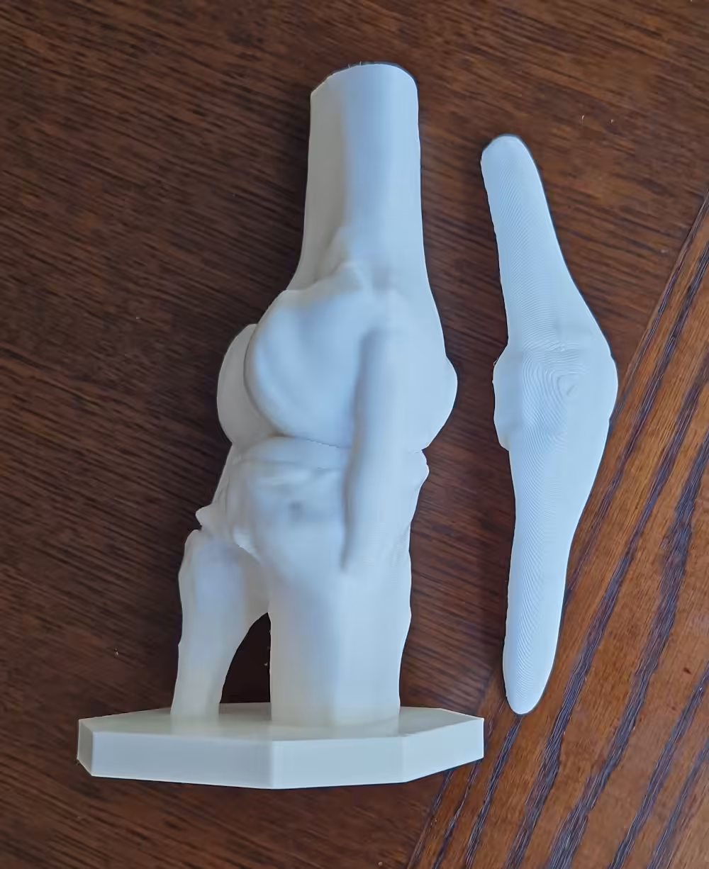 Preview - High-precision anatomical knee joint